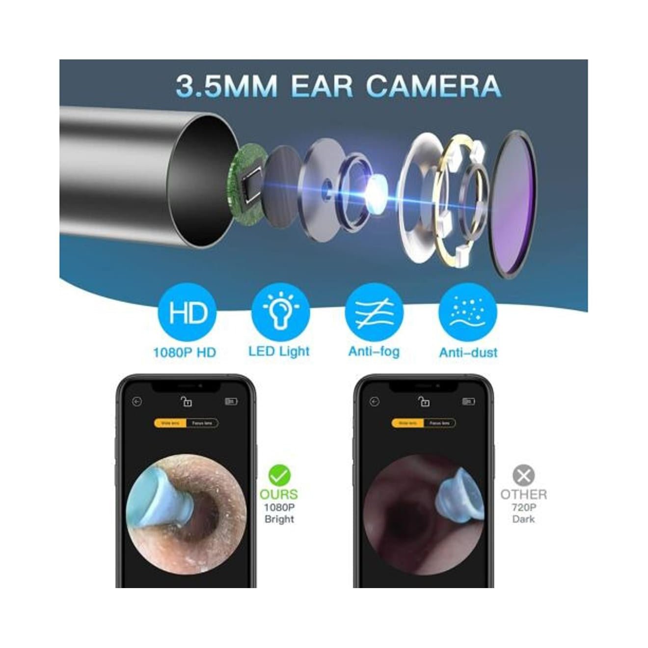 Bebird Smart Earwax Removal Tool R1 - Black