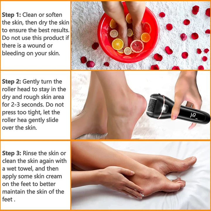 Electric Foot Callus Removal Kit ZCA018