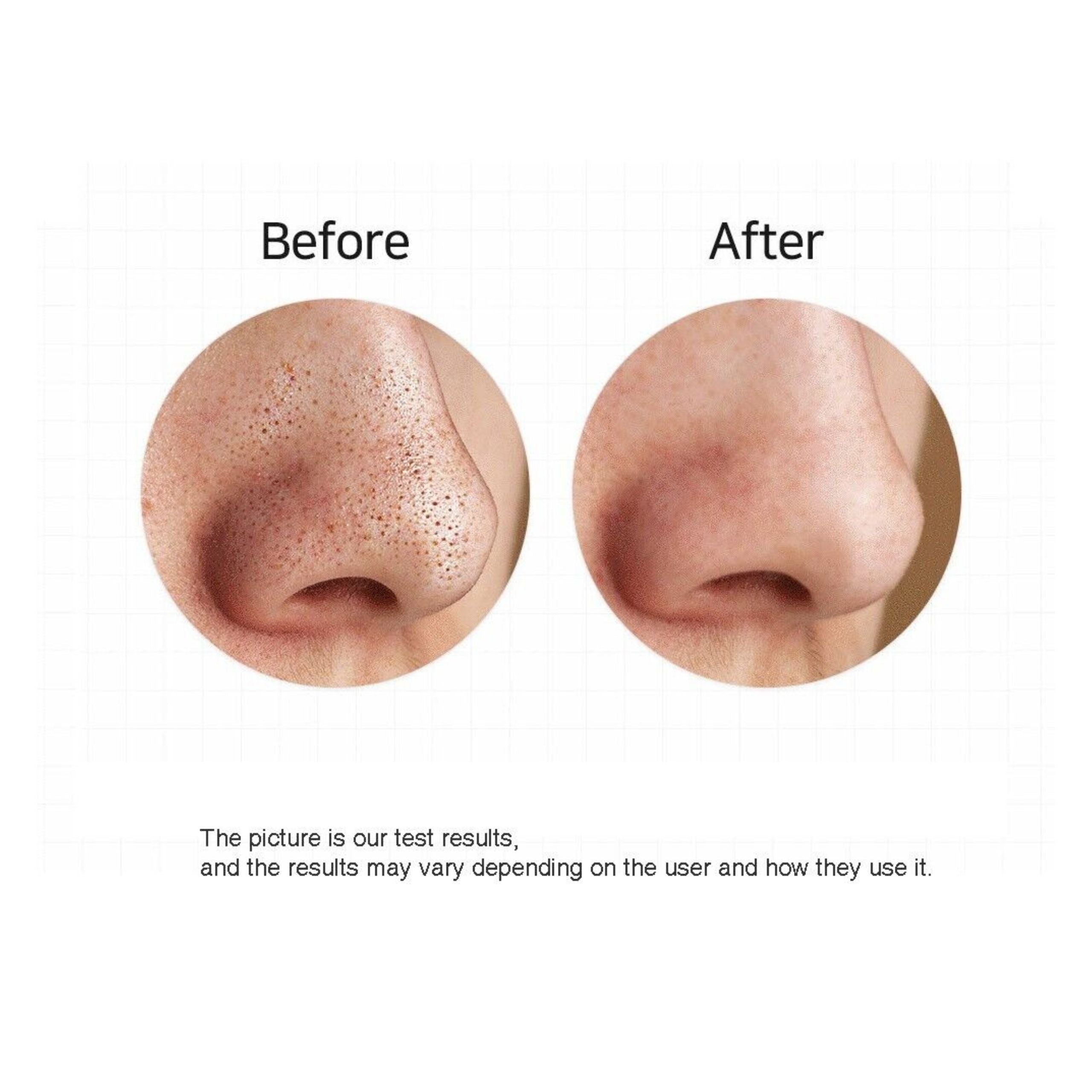 Green Lion Facial Blackhead Remover 650mAh 2.5W - White