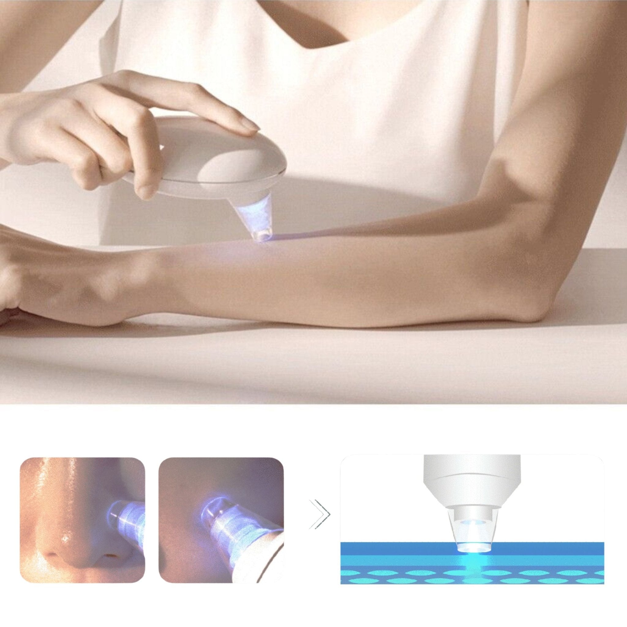 Green Lion Facial Blackhead Remover 650mAh 2.5W - White