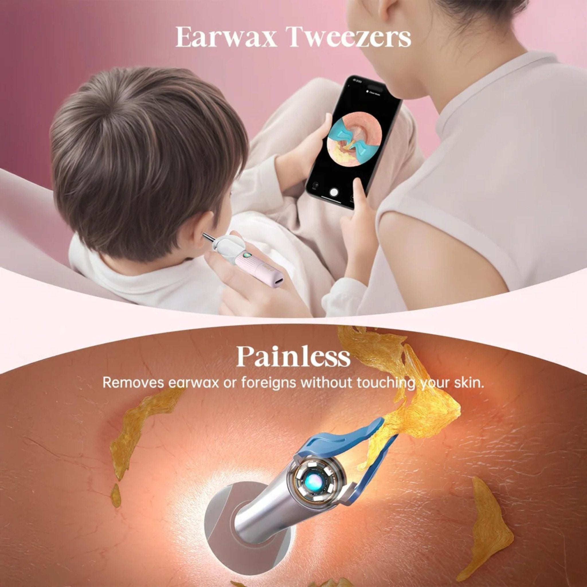 Bebird EarSight Plus Compact All-in-1 Visual Ear Wax Remover