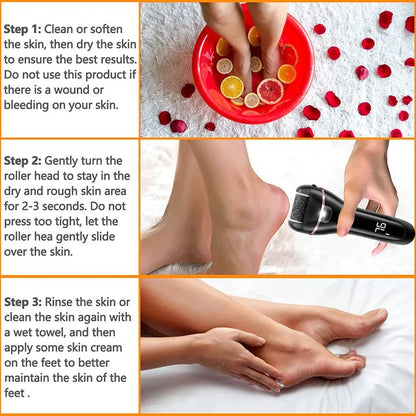 Electric Foot Callus Removal Kit ZCA018