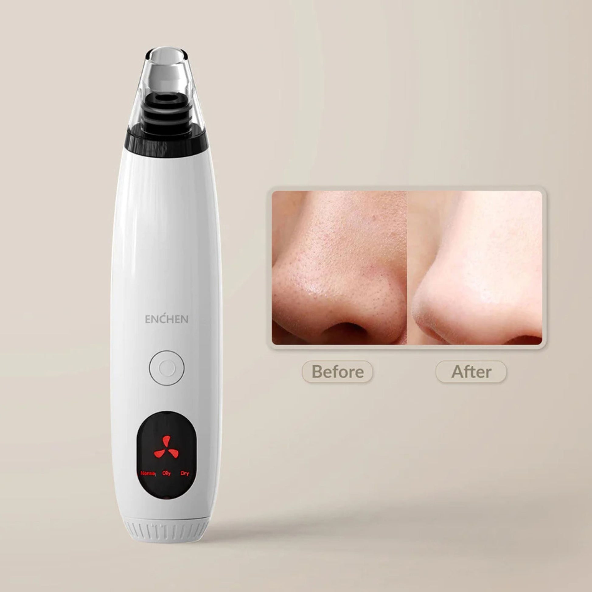 Enchen Blackhead Remover EB1001 - White