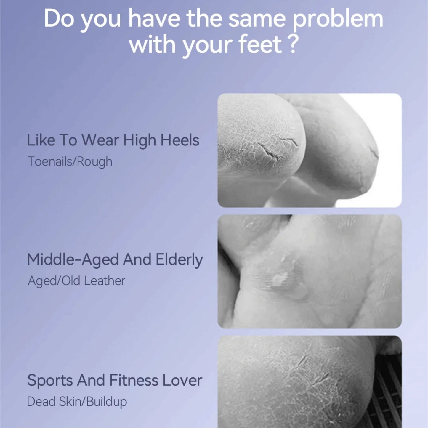 Enchen - Rock Electric Foot Callus Remover EMJ001 - White