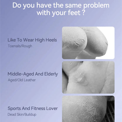 Enchen - Rock Electric Foot Callus Remover EMJ001 - White