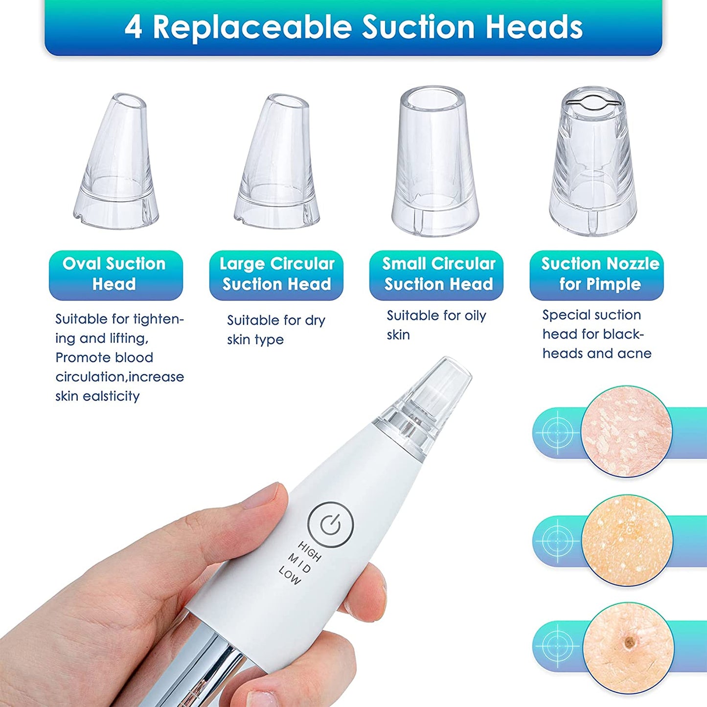 Xiaomi InFace Blackhead Remover MS7000