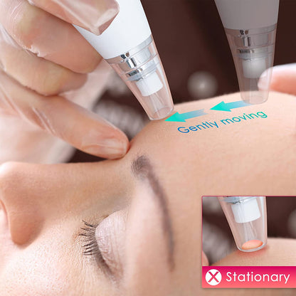 Xiaomi InFace Blackhead Remover MS7000