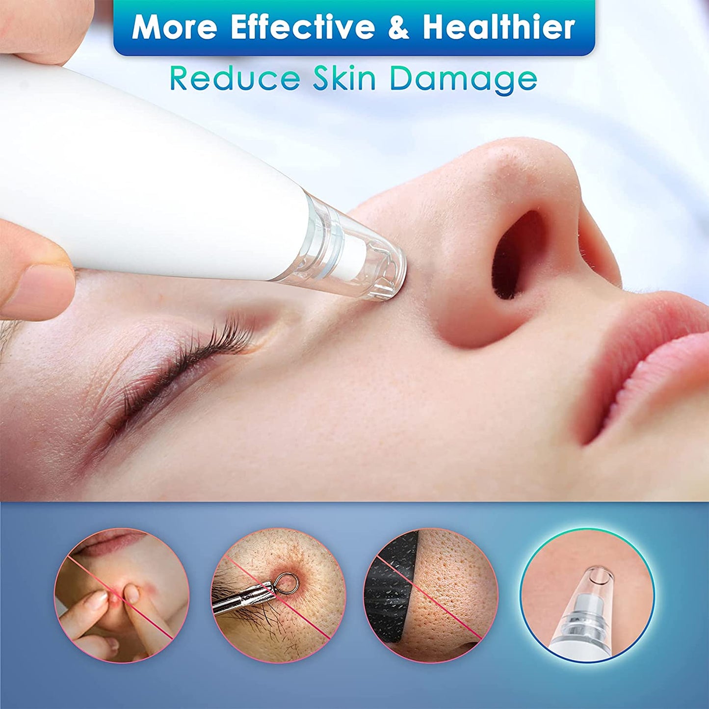 Xiaomi InFace Blackhead Remover MS7000