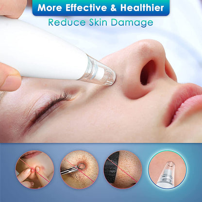 Xiaomi InFace Blackhead Remover MS7000