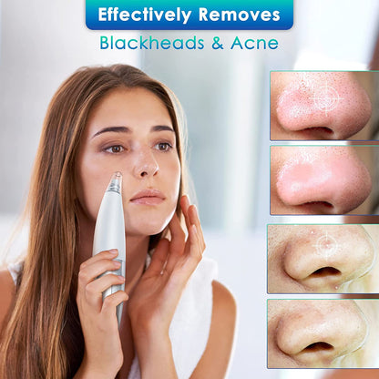Xiaomi InFace Blackhead Remover MS7000